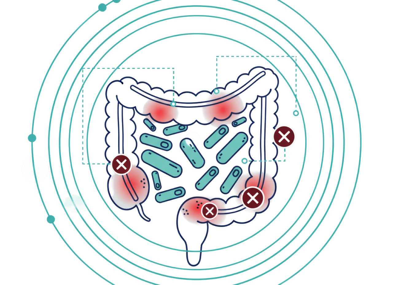 Clostridium Difficile (C. diff) 