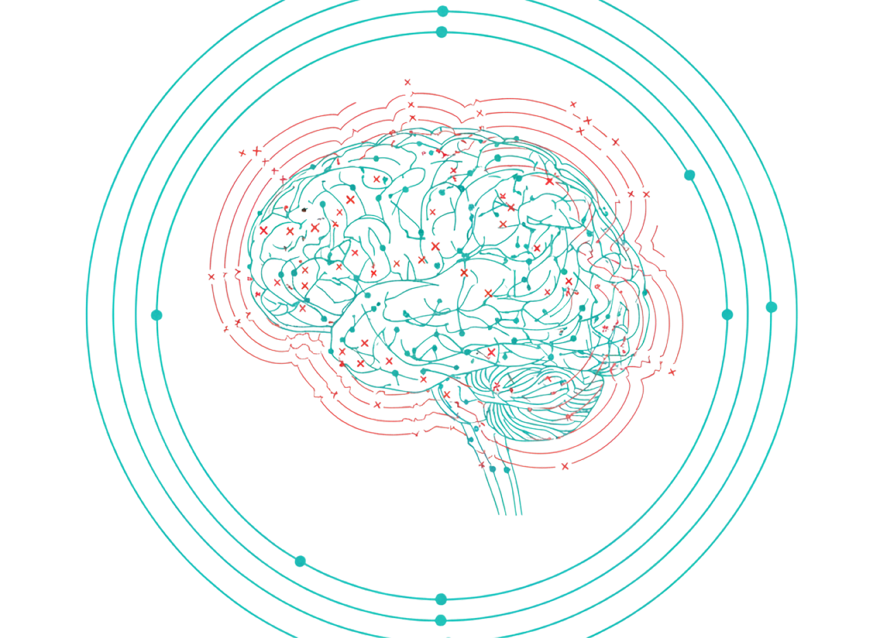 Epilepsy 