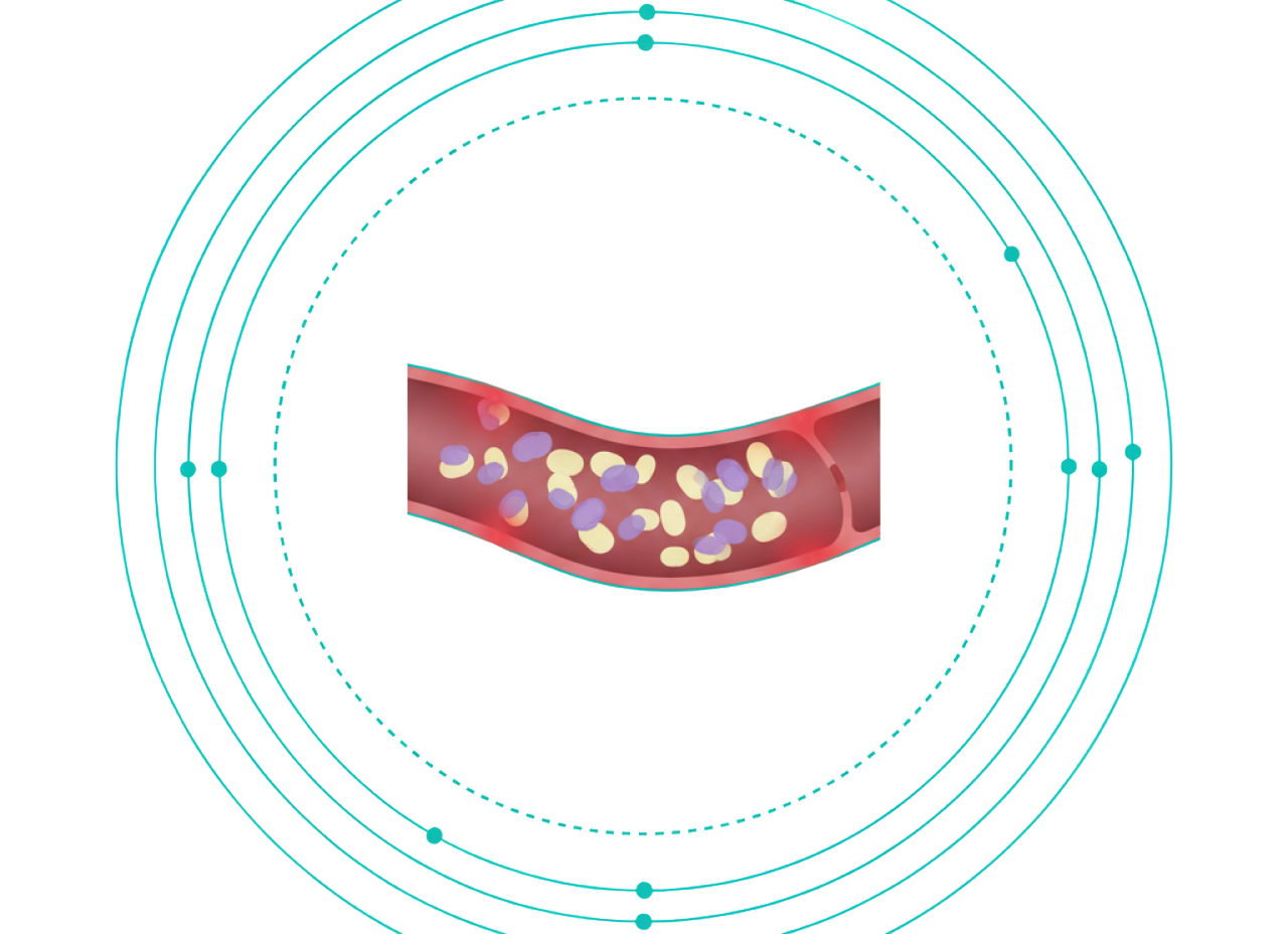 Hyperlipidemia 