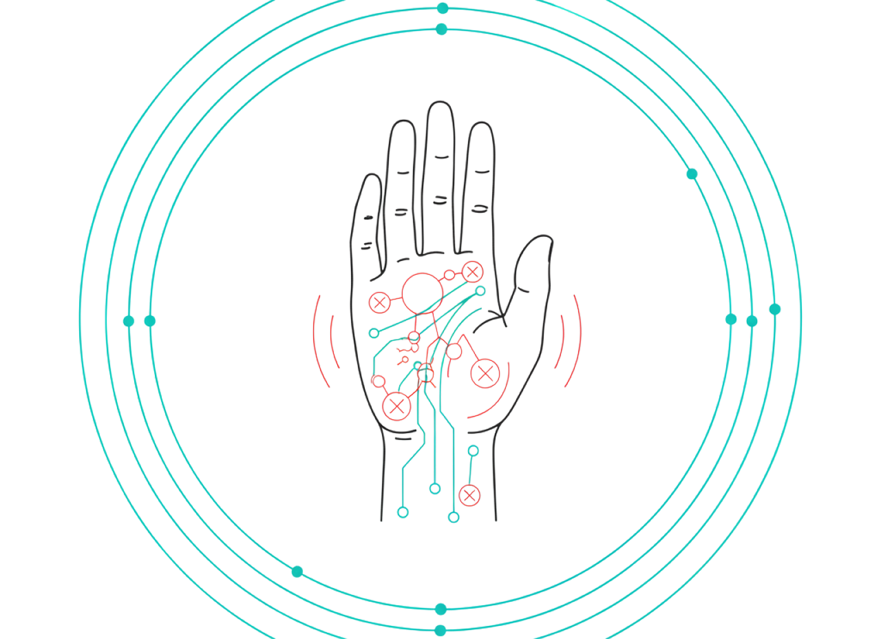 Parkinson’s Disease 