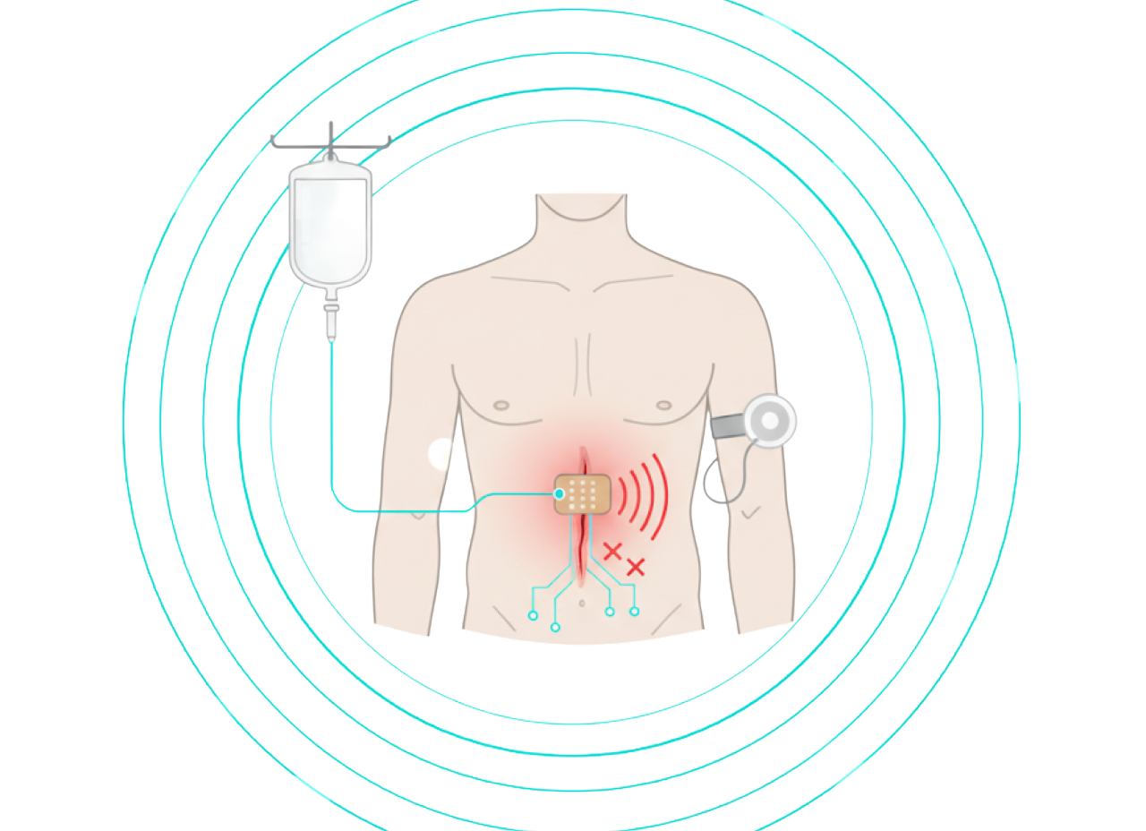 Post Surgical Pain Control 